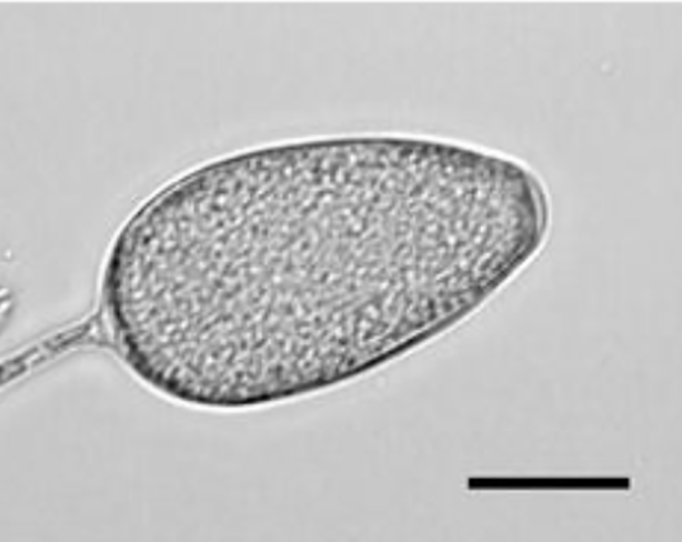   Phytophthoranbsp;chlamydosporanbsp; asexual phase: persistent nonpapillate sporangium; Scale bar = 20mu;m; photos by Paul Reeser. 
